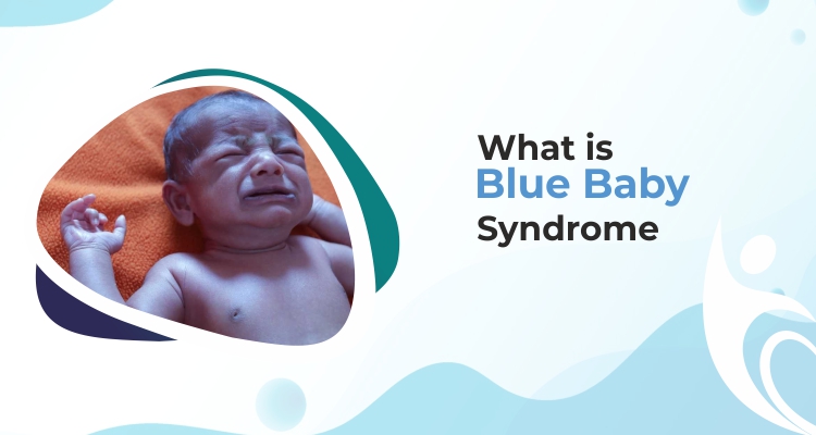 What Is Blue Baby Syndrome